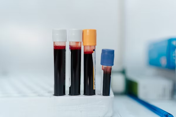 Comment renforcer son système immunitaire : 8 stratégies naturelles validées par la science