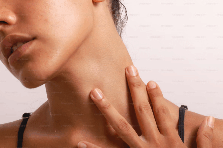 Comment perdre son double menton : solutions naturelles et esthétiques efficaces
